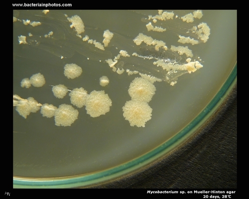 mueller hinton agar mycobacterium